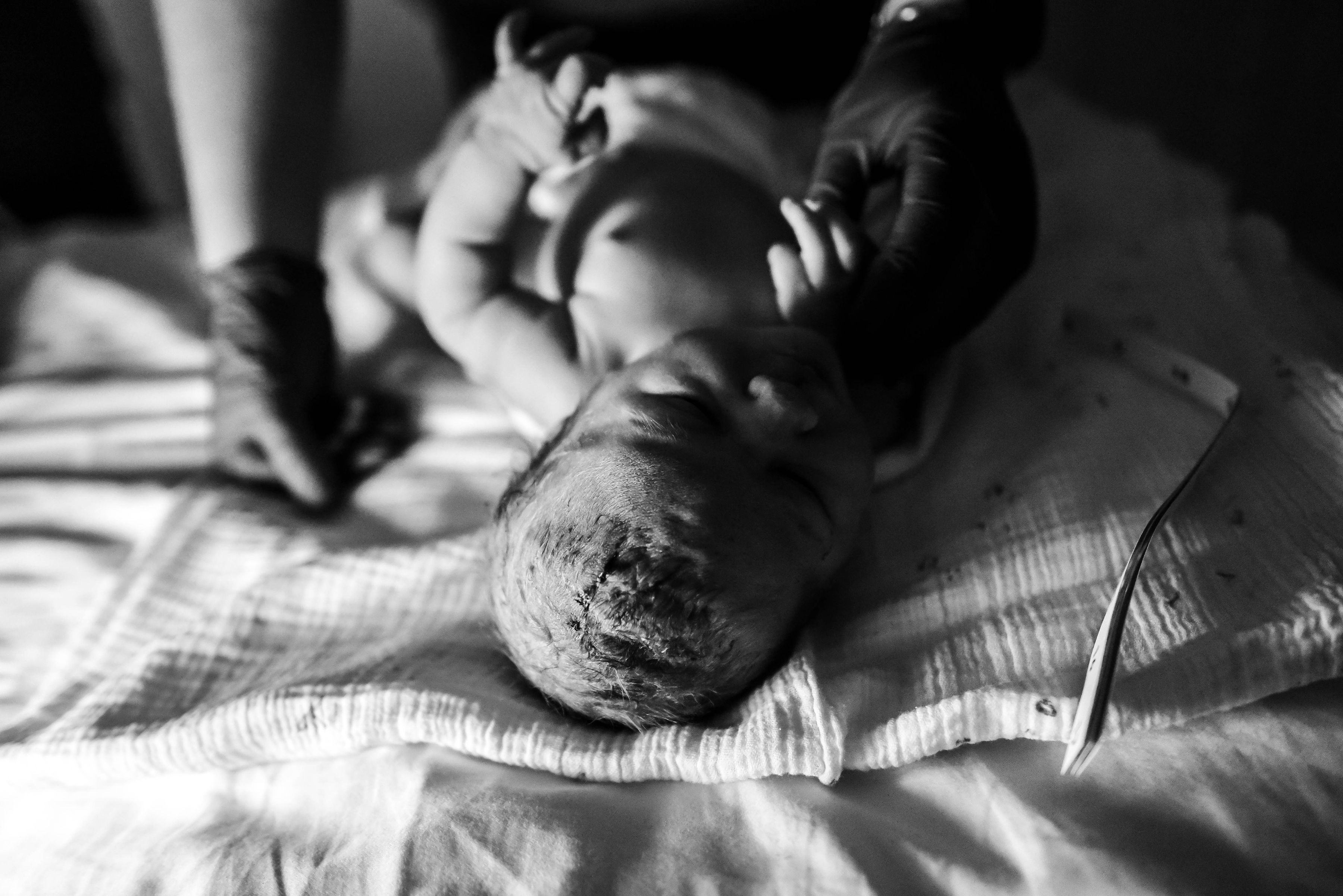Black and white image of newborn baby lying on blanket while midwife exams