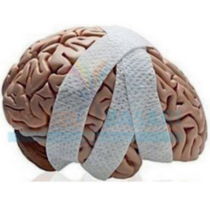 Image for Concussion Recovery and Long Haul Covid Recovery